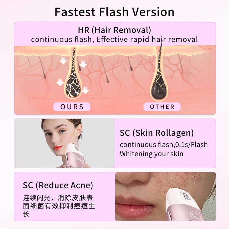 Buz Soğutmalı Pratik Epilasyon - Epilator Wireless incelemesi ve fiyatı